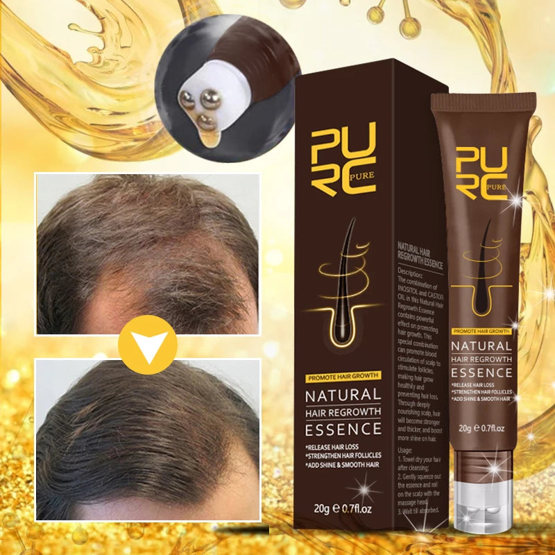 PURC Ginger Hair Serum Strengthen Hair Follicles Oil Smoothing Hair Scalp Treatment Hair Care for Men Women