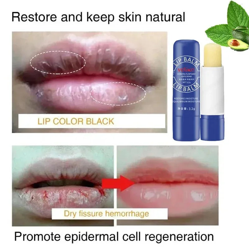 Lip Balm Whitening Remove Dark Lighten Melanin Lip Mask Fade Lip Line Brighten Exfoliating Moisturize Dead Skin Repair Lip Care