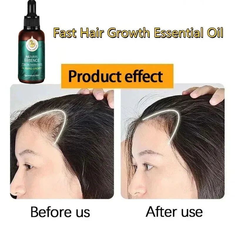 Hair Fast Growth Hair Care Essential Oil Natural Ginger Hair Regrowth Products Serum Hair Care Anti Hair Loss Series