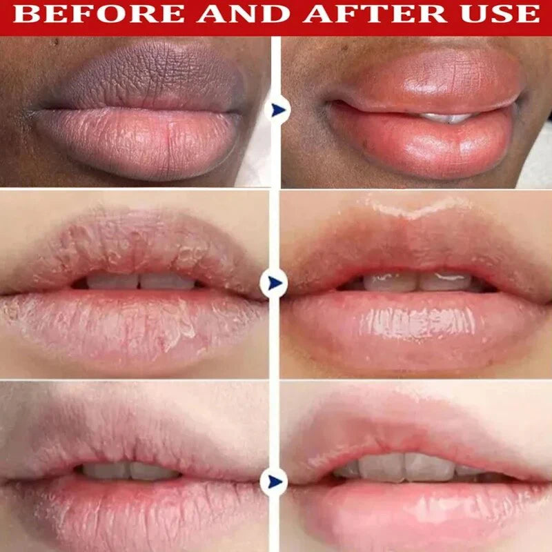 Lip Balm Whitening Remove Dark Lighten Melanin Lip Mask Fade Lip Line Brighten Exfoliating Moisturize Dead Skin Repair Lip Care