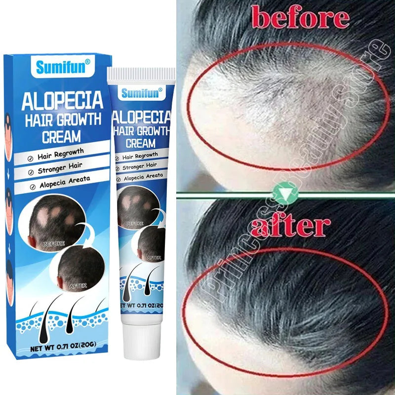 Hair Growth Cream Anti Hair Loss Products Fast Growing Prevent Dry Frizz Damaged Repair Treatment Scalp Beard Care Men Women