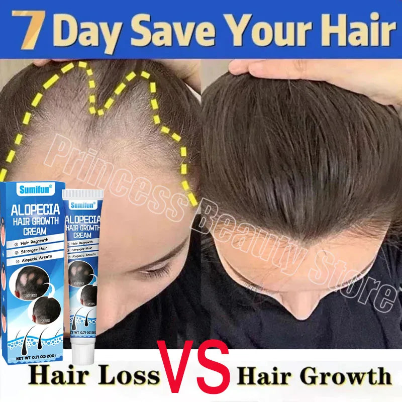 Hair Growth Cream Anti Hair Loss Products Fast Growing Prevent Dry Frizz Damaged Repair Treatment Scalp Beard Care Men Women