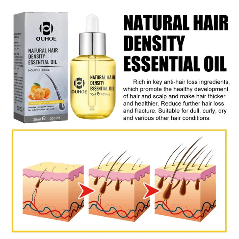 Orange Peel Fast Hair Growth for Men Women Ginger Anti Hair Loss Scalp Treatment Essential Oil Regrowth Thicken Hair Care Serum