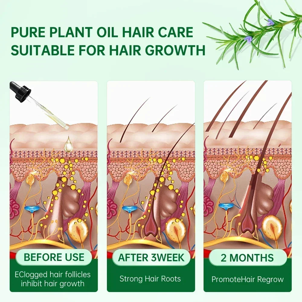 Anti Hair Loss Scalp Treatment Hair Care Fast Growing Products Essential Oils Ginger  Rosemary Oil Hair Growth for Men Women