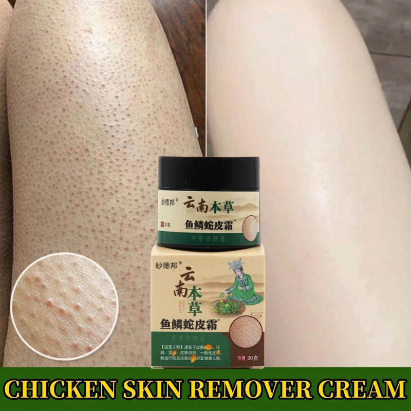 Herbal Repair Chicken Skin Cream Moisturize Remove Thick Pore Dark Spot Body Scrub Curing Keratosis Follicle Pilaris Smooth Skin