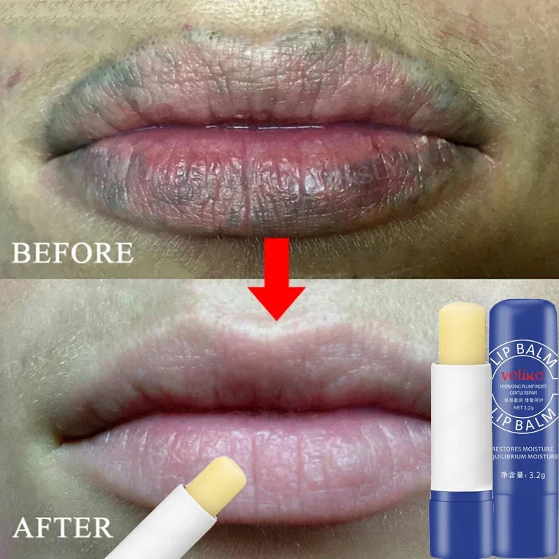 Remove Dark Lip Balm Lighten Melanin Lip Mask Exfoliating Fade Lip Line Dead Skin Moisturizing Brighten Repair Lip Care Products