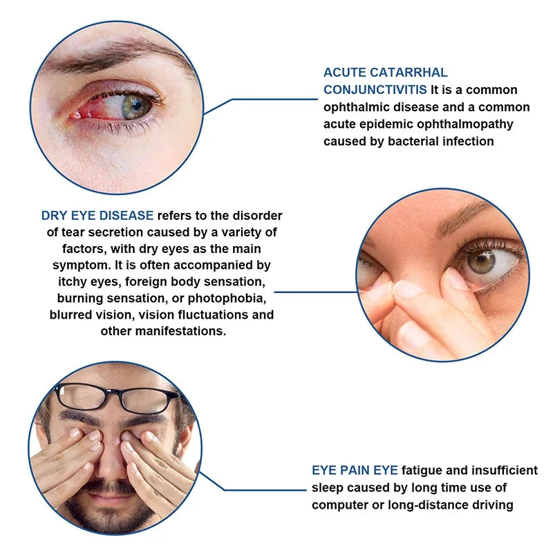 Rapid Treatment Myopia,Protect Eyesight Cream,Relieve Vision Astigmatism,Eye Pressure Fatigue Dry Blurred for Eye Health Care