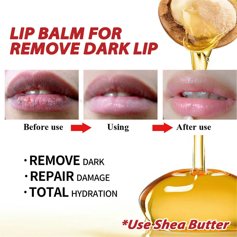 Lip Balm For Remove Dark Lip Moisturizing Lightening Melanin Whitening Plumper Extreme Gloss Pink Lips Skin Care For Men Women