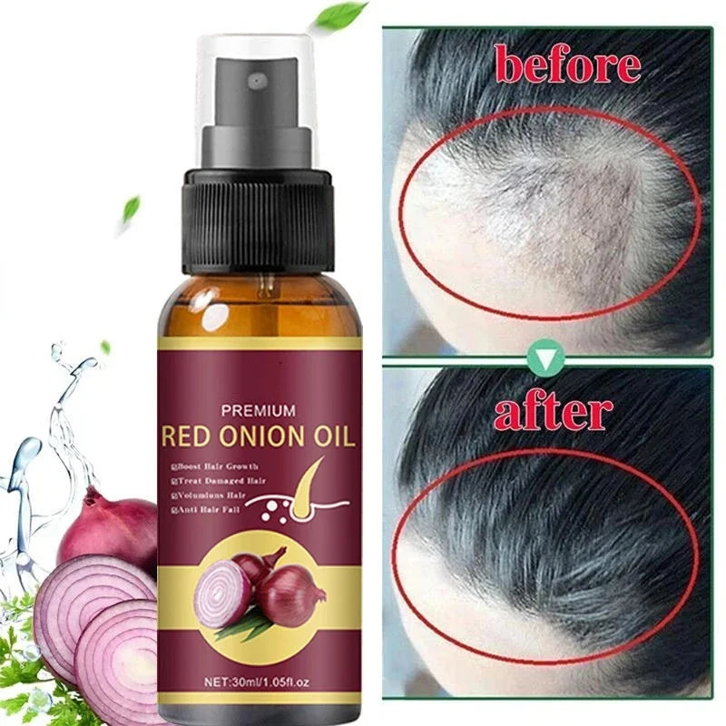 Powerful Hair Growth Serum Spray Regrowth Hair Anti Hair Loss Treatment Essence Repair Hair Nourish Root For Men Women Hair Care