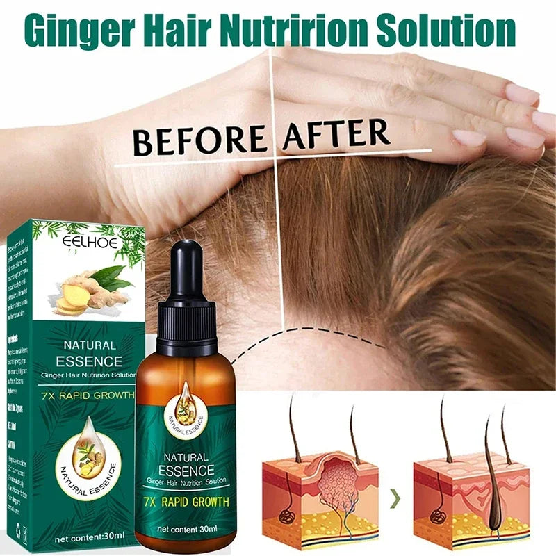 Hair Fast Growth Hair Care Essential Oil Natural Ginger Hair Regrowth Products Serum Hair Care Anti Hair Loss Series