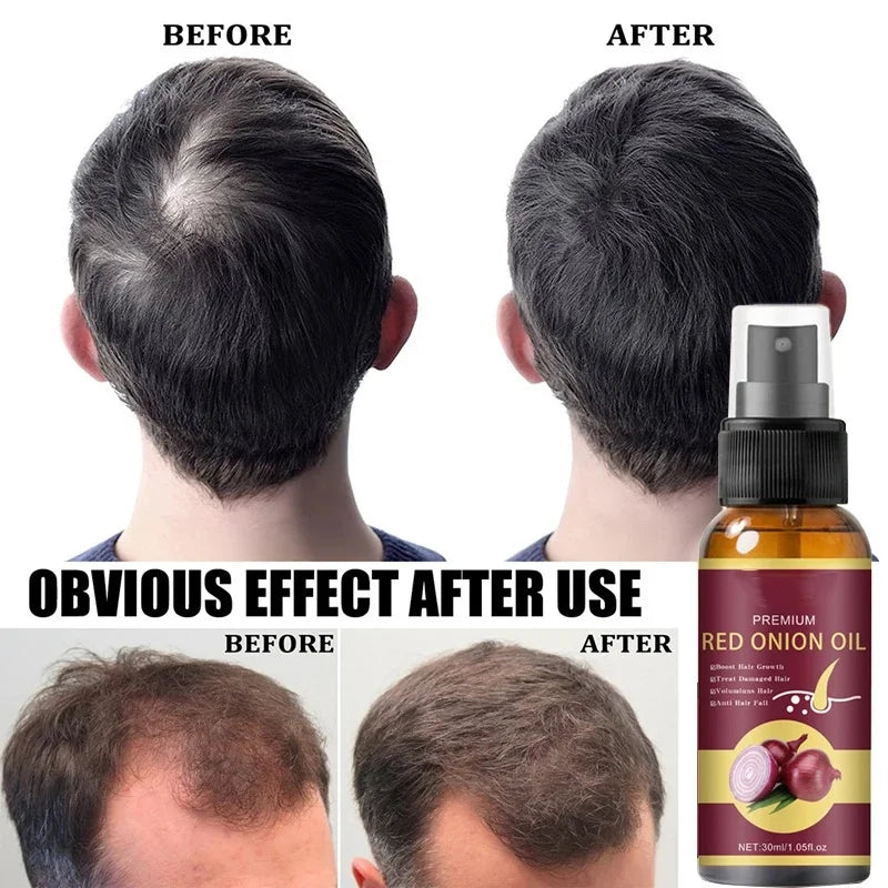 Powerful Hair Growth Serum Spray Regrowth Hair Anti Hair Loss Treatment Essence Repair Hair Nourish Root For Men Women Hair Care