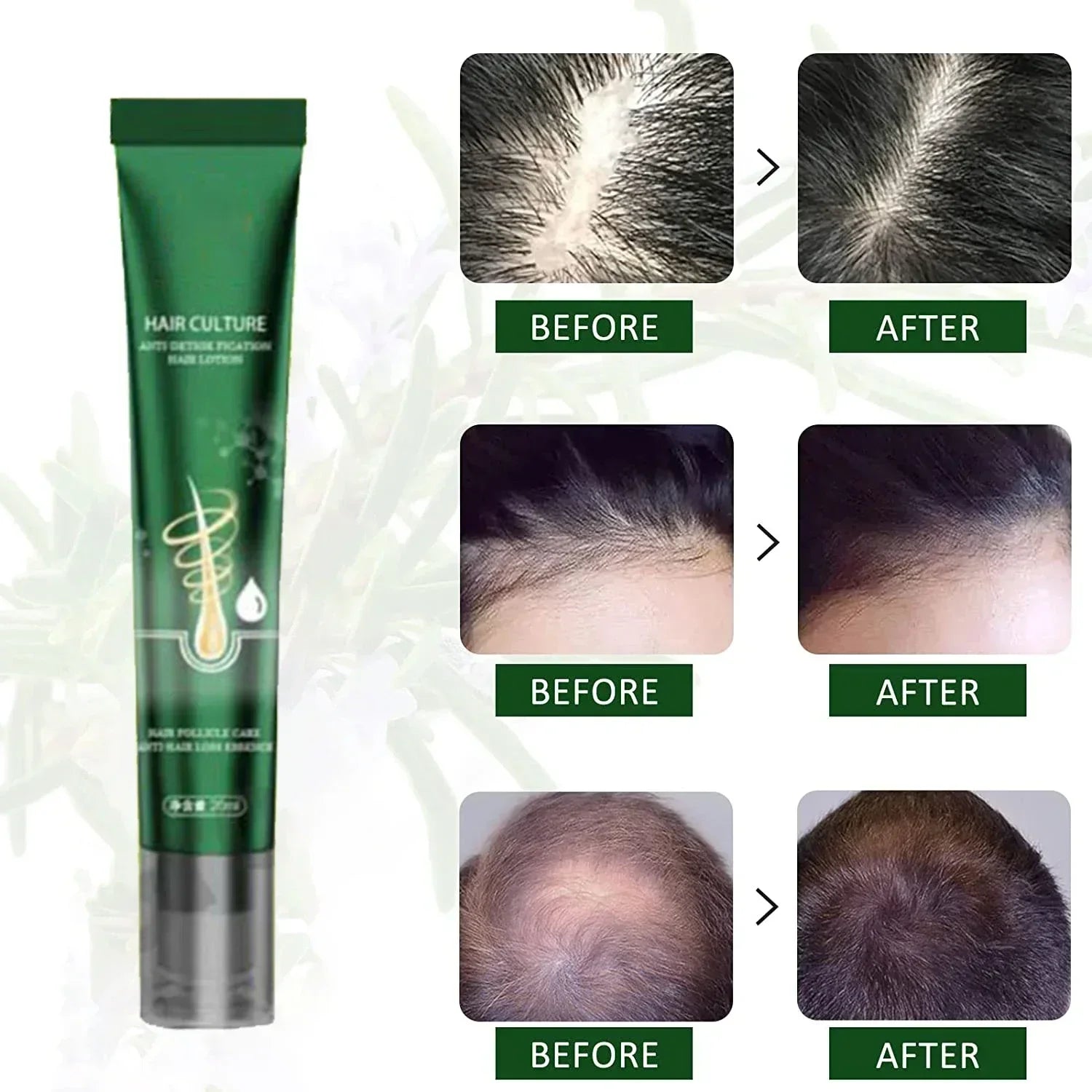 Hair Growth Essential Loss Regrowth Treatment Strengthens Hair Nourishes Scalp Light Weight Non Greasy Improve Scalp Circulation