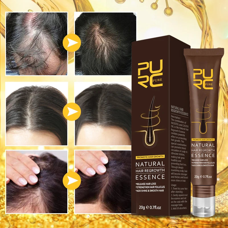 PURC Ginger Hair Serum Strengthen Hair Follicles Oil Smoothing Hair Scalp Treatment Hair Care for Men Women