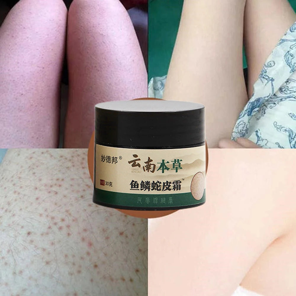 Herbal Repair Chicken Skin Cream Moisturize Remove Thick Pore Dark Spot Body Scrub Curing Keratosis Follicle Pilaris Smooth Skin